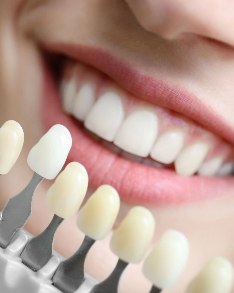 Odontologia estética